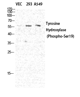 Fig.1. Western Blot analysis of various cells using Phospho-TH (S19) Polyclonal Antibody diluted at 1:1000.