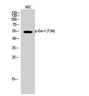 Fig.2. Western Blot analysis of VEC cells using Phospho-Ets-1 (T38) Polyclonal Antibody.