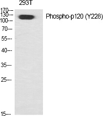 Fig.1. Western Blot analysis of various cells using Phospho-p120 (Y228) Polyclonal Antibody diluted at 1:500.