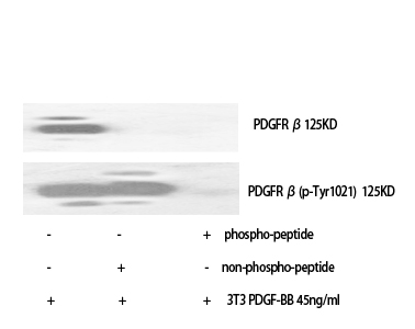 Fig. Western Blot analysis of various cells using Phospho-PDGFR-β (Y1021) Polyclonal Antibody.