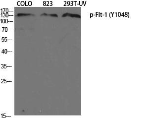 Fig.1. Western Blot analysis of various cells using Phospho-Flt-1 (Y1048) Polyclonal Antibody diluted at 1:1000.