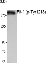 Fig. Western Blot analysis of extracts from K562 cells, using Phospho-Flt-1 (Y1213) Polyclonal Antibody.