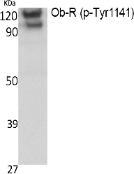 Fig. Western Blot analysis of extracts from K562 cells, using Phospho-Ob-R (Y1141) Polyclonal Antibody.