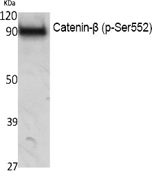 Fig. Western Blot analysis of extracts from NIH-3T3 cells, using Phospho-Catenin-β (S552) Polyclonal Antibody.