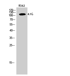 Fig.2. Western Blot analysis of K562 cells using 4.1G Polyclonal Antibody.