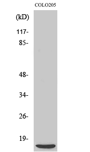 Fig. Western Blot analysis of various cells using 4E-BP1 Polyclonal Antibody diluted at 1:500.