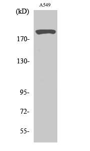 Fig. Western Blot analysis of various cells using 53BP1 Polyclonal Antibody diluted at 1:2000.