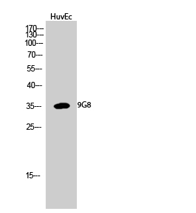 Fig.2. Western Blot analysis of HuvEc cells using 9G8 Polyclonal Antibody.