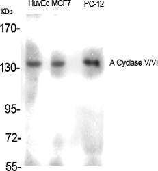 Fig.1. Western Blot analysis of various cells using A Cyclase V/VI Polyclonal Antibody.