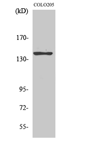 Fig.2. Western Blot analysis of COLO205 cells using A Cyclase V/VI Polyclonal Antibody.
