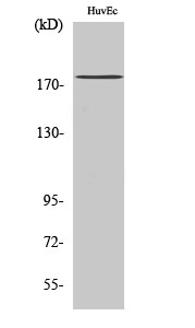 Fig.2. Western Blot analysis of HuvEc cells using ABCA8 Polyclonal Antibody.