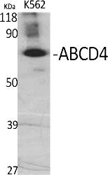 Fig.1. Western Blot analysis of various cells using ABCD4 Polyclonal Antibody diluted at 1:500.