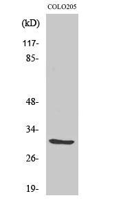Fig. Western Blot analysis of various cells using ABHD11 Polyclonal Antibody.