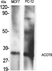 Fig.1. Western Blot analysis of various cells using ACOT8 Polyclonal Antibody.