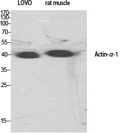 Fig.1. Western Blot analysis of various cells using Actin α1 Polyclonal Antibody diluted at 1:500.
