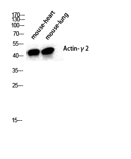 Fig.1. Western Blot analysis of various cells using Actin α3 Polyclonal Antibody diluted at 1:2000.