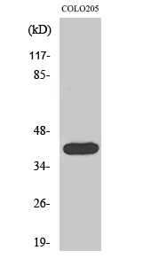 Fig.2. Western Blot analysis of COLO205 cells using Actin α3 Polyclonal Antibody diluted at 1:2000.