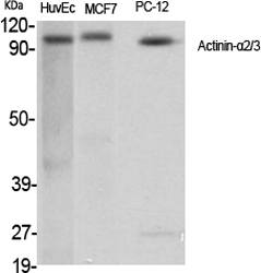 Fig.1. Western Blot analysis of various cells using Actinin-α2/3 Polyclonal Antibody.