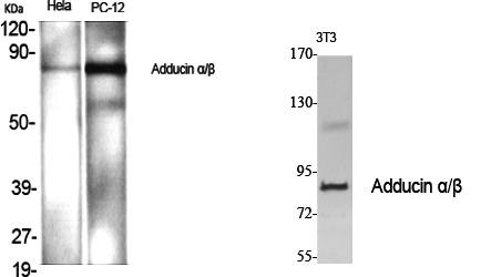 Fig.1. Western Blot analysis of various cells using Adducin α/β Polyclonal Antibody diluted at 1:1000.
