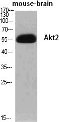 Fig.1. Western Blot analysis of various cells using Akt2 Polyclonal Antibody diluted at 1:500.