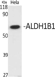 Fig.1. Western Blot analysis of various cells using ALDH1B1 Polyclonal Antibody diluted at 1:1000.