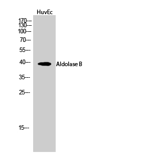 Fig.2. Western Blot analysis of HuvEc cells using Aldolase B Polyclonal Antibody.
