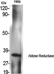 Fig.1. Western Blot analysis of various cells using Aldose Reductase Polyclonal Antibody.