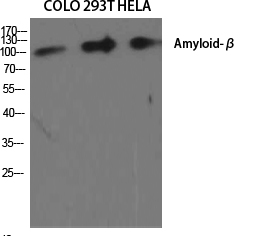 Fig.1. Western Blot analysis of various cells using Amyloid-β Polyclonal Antibody diluted at 1:2000.