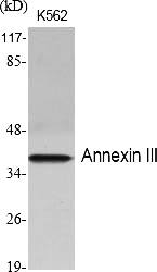 Fig.1. Western Blot analysis of various cells using Annexin III Polyclonal Antibody diluted at 1:2000.