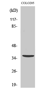 Fig.2. Western Blot analysis of COLO205 cells using Apaf-1-ALT Polyclonal Antibody diluted at 1:500.
