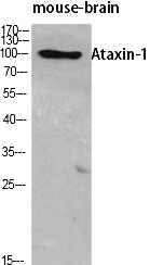 Fig. Western Blot analysis of various cells using Ataxin-1 Polyclonal Antibody diluted at 1:500.