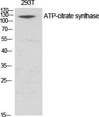 Fig.1. Western Blot analysis of various cells using ATP-citrate synthase Polyclonal Antibody diluted at 1:1000.
