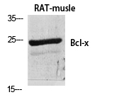 Fig.1. Western Blot analysis of various cells using Bcl-x Polyclonal Antibody diluted at 1:500.