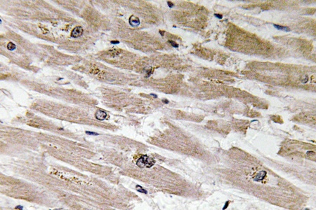 Fig.3. Immunohistochemistry of paraffin-embedded human heart tissue using antibody at dilution 1:100.