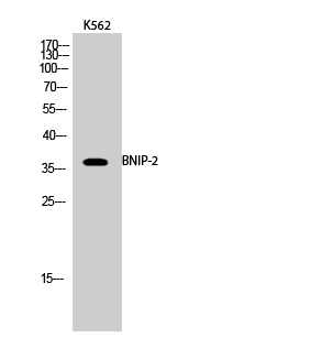 Fig.2. Western Blot analysis of K562 cells using BNIP-2 Polyclonal Antibody.