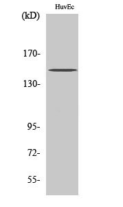 Fig. Western Blot analysis of various cells using BRCAA1 Polyclonal Antibody.