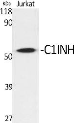 Fig.1. Western Blot analysis of various cells using C1INH Polyclonal Antibody.