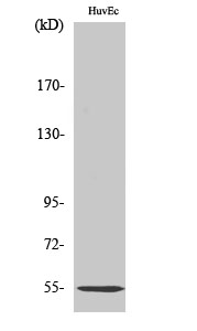 Fig.2. Western Blot analysis of HuvEc cells using C1INH Polyclonal Antibody.