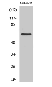 Fig.2. Western Blot analysis of COLO205 cells using CABC1 Polyclonal Antibody.