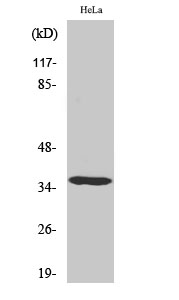 Fig. Western Blot analysis of various cells using Casein Kinase Iα Polyclonal Antibody.