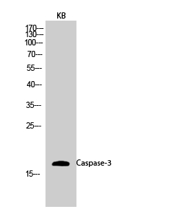 Fig.2. Western Blot analysis of KB cells using Caspase-3 Polyclonal Antibody diluted at 1:1000.