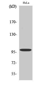 Fig. Western Blot analysis of various cells using Catenin-α E/N Polyclonal Antibody diluted at 1:500.