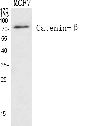 Fig.1. Western Blot analysis of various cells using Catenin-β Polyclonal Antibody diluted at 1:1000.