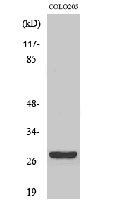 Fig. Western Blot analysis of various cells using CD160 Polyclonal Antibody.