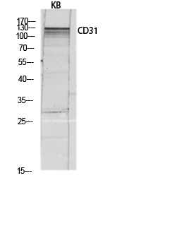Fig.3. Western blot analysis of KB lysis using CD31 antibody. Antibody was diluted at 1:1000.