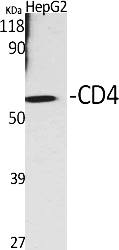 Fig.1. Western Blot analysis of various cells using CD4 Polyclonal Antibody diluted at 1:500.