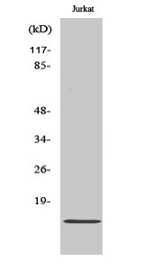 Fig. Western Blot analysis of various cells using Cdc42EP5 Polyclonal Antibody diluted at 1:500.