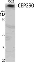 Fig. Western Blot analysis of various cells using CEP290 Polyclonal Antibody.