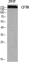 Fig.1. Western Blot analysis of various cells using CFTR Polyclonal Antibody diluted at 1:2000.
