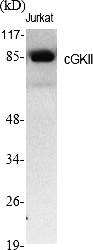 Fig.1. Western Blot analysis of various cells using cGKII Polyclonal Antibody.